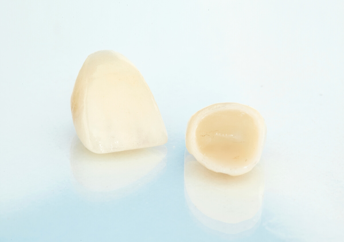 Porcelain Dental Crowns in Chevy Chase, MD area